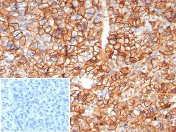 CD99 Antibody / MIC2