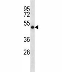 SOCS4 Antibody