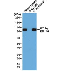 IP and detect of 293T cells expressing a His-Tag fusion protein using recombinant His Tag antibody. 