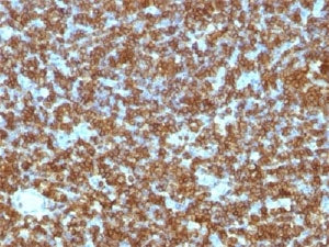 IHC staining of FFPE human tonsil tissue with CD45RA antibody (clone PTPRC/1131). HIER: boil tissue 