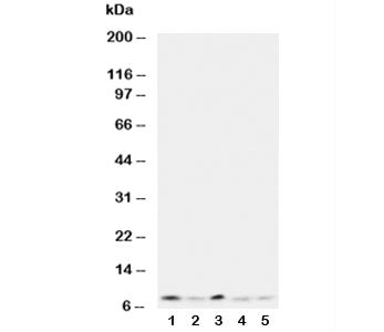 Western blot testing of Ubiquitin antibody and Lane 1: rat thymus; 2: human MCF-7; 3: MM231; 4: HeLa