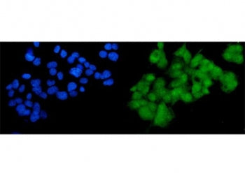 Immunofluorescent staining of FFPE human HepG2 cells with SOX18 antibody (green) and DAPI nuclear st