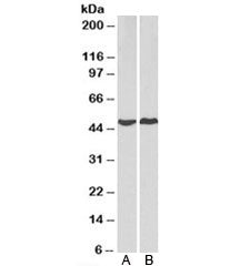 PRKACA Antibody
