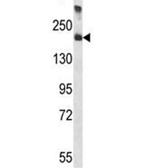 Alpha-2-macroglobulin Antibody