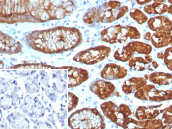 Glutamine Synthetase Antibody / GLUL
