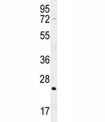 H-RAS Antibody