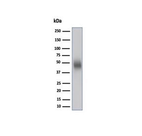 Western blot testing of human Raji cell lysate using CD48 antibody (clone CD48/4783). Predicted mole