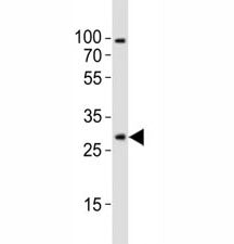 Western blot analysis of lysate from mouse brain tissue lysate using Olig1 antibody diluted at 1:100