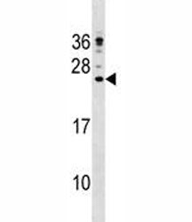 CAMP Antibody