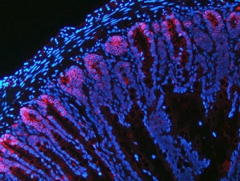 Immunofluorescent staining of FFPE rat colon tissue with NKCC1 antibody (red) and DAPI nuclear stain