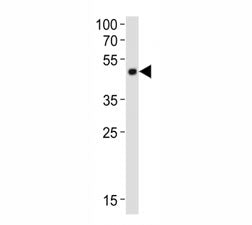 Western blot analysis of lysate from mouse cerebellum tissue lysate using Pax6 antibody diluted at 1