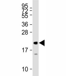 Western blot testing of human recombinant MLL2 protein with MML2 antibody at 1:27000.