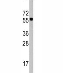 CDC6 Antibody