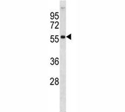 AKT2 Antibody