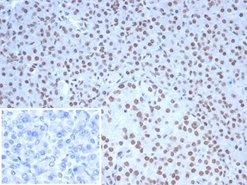 IHC staining of FFPE human pancreatic tissue with Nucleolin antibody (clone NCL/7338). HIER: boil ti