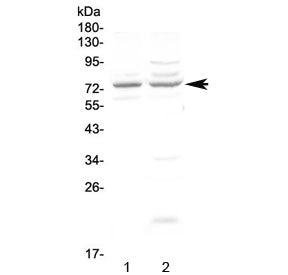 CHM Antibody / Choroideremia protein