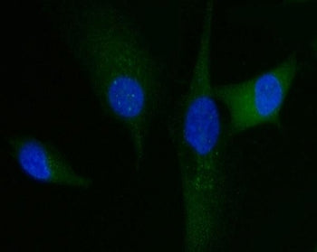 HRS Antibody / HGS / HGF-regulated tyrosine kinase substrate