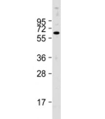 Western blot testing of human HepG2 cell lysate with PTH1R antibody at 1:2000. Expected molecular we