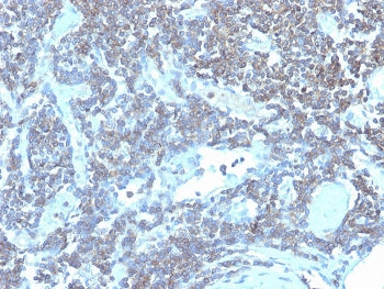 IHC staining of FFPE human lymph node with CD48 antibody (clone CD48/4784). HIER: boil tissue sectio