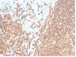 IHC staining of FFPE human tonsil tissue with recombinant CD20 antibody (clone rMS4A1/7280) at 2ug/m