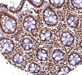 HSP70 Antibody / HSPA1B