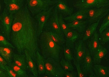 Immunofluorescent staining of FFPE human A549 cells with SMC1A antibody (red) and Beta Tubulin mAb (