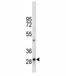 TPSAB1 Antibody