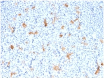IHC staining of FFPE human tonsil tissue with SPARC antibody (clone OSTN/3755). HIER: boil tissue se