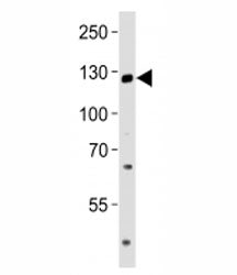 TRPM8 Antibody