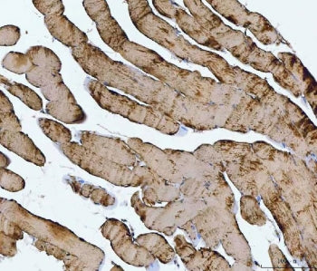 IHC staining of FFPE human skeletal muscle tissue with TNNI1 antibody. HIER: boil tissue sections in