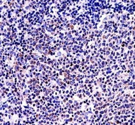 BAFF antibody immunohsitochemistry analysis in formalin fixed and paraffin embedded human tonsil tis