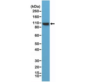 ACTN4 Antibody / Alpha Actinin 4 / N-Terminal