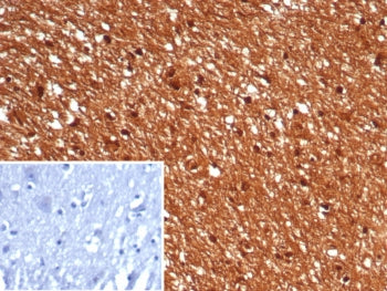GBX2 Antibody / Gastrulation Brain Homeobox 2