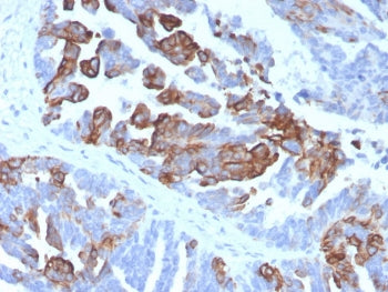 Cytokeratin 17 Antibody
