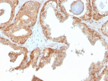 IHC staining of FFPE human prostate with Superoxide Dismutase 1 antibody. HIER: boil tissue sections