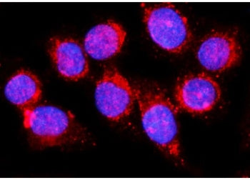 EHD1 Antibody / EH domain-containing protein 1 / PAST1