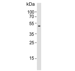 PEDF Antibody / Pigment epithelium-derived factor / SERPINF1