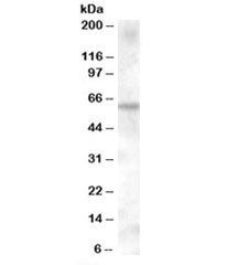 Western blot testing of human muscle lysate with KPNA6 antibody at 0.1ug/ml. Predicted molecular wei