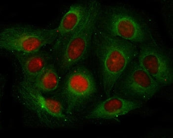 Immunofluorescent staining of FFPE human U-2 OS cells with Angiogenin antibody (green) and DAPI nucl