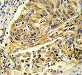 Clathrin Light Chain A Antibody