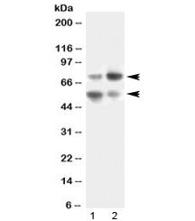 Western blot testing of human 1) SKOV3 and 2) HeLa lysate with VNN1 antibody at 0.5ug/ml. Expected m