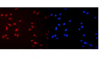 MCM2 Antibody