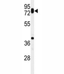 HAS1 Antibody