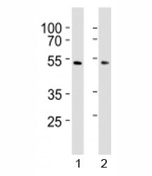 Western blot analysis of lysate from 1) HepG2 and 2) HUVEC cell line using SUV39H2 antibody at 1:100