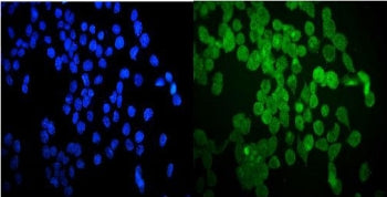 HSP20 Antibody