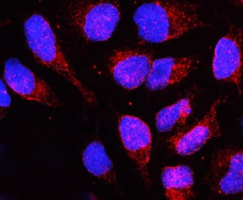 LBR Antibody / Lamin B Receptor