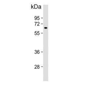 MTMR9 Antibody / Myotubularin-related protein 9