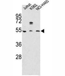 Western blot analysis of APOA4 antibody and Jurkat, K562, NCI-H460 lysate. Predicted molecular weigh