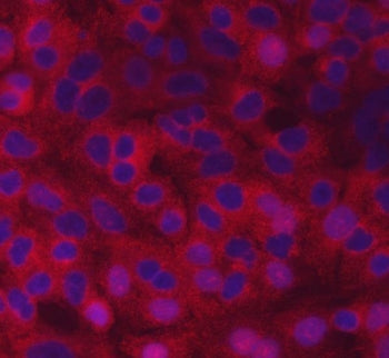 Immunofluorescent staining of FFPE human A549 cells with CVAK104 antibody (red) and DAPI nuclear sta