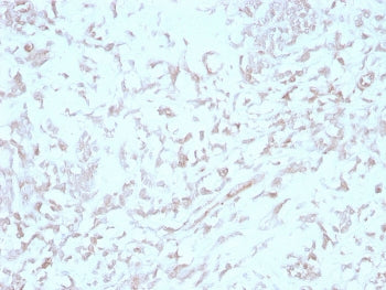 IHC staining of FFPE human liver with Kindlin-1 antibody (clone 4A5.14). HIER: boil tissue sections 
